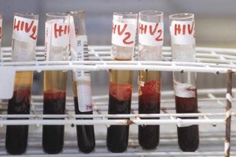 Prevención del VIH con inyección semestral contra el SIDA.