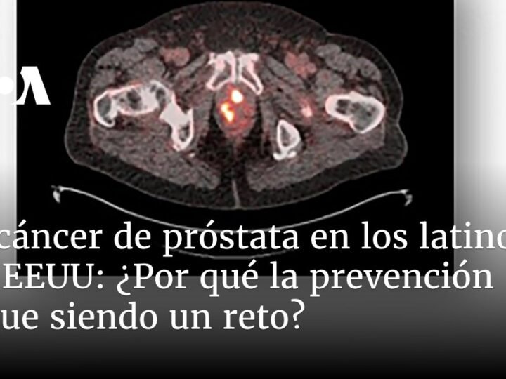 ¿Cuál es el desafío que enfrenta la prevención?