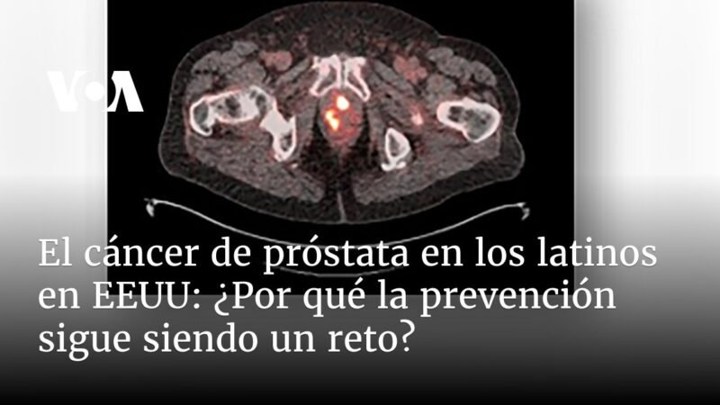 ¿Cuál es el desafío que enfrenta la prevención?