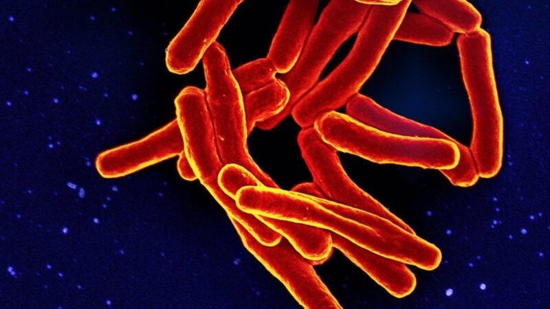 Niños en entornos con alta carga de tuberculosis: riesgo de desarrollar la enfermedad